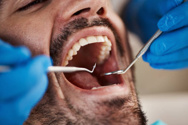 Best Laser Dentistry  in Panhandle, TX